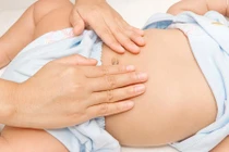 Dấu hiệu nhận biết ung thư bạch cầu ở trẻ