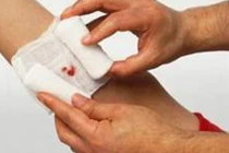 Bí mật quan trọng bạn cần biết về rối loạn đông máu