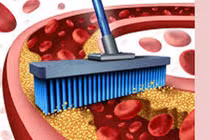 Thực phẩm cực tốt cho người bị máu nhiễm mỡ