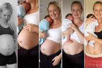 Ảnh mẹ trẻ dũng cảm khoe bụng thật từng cm sau sinh