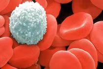 Nguyên nhân khiến trẻ mắc ung thư ngay từ khi lọt lòng