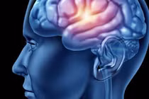 Dấu hiệu thường gặp khi bị ung thư não