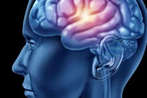 Dấu hiệu thường gặp khi bị ung thư não