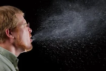 Dấu hiệu cảnh báo ung thư dễ bị bỏ qua