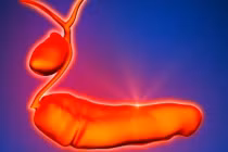 Sự thật đáng sợ về ung thư tuyến tụy