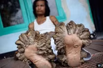 Những hình ảnh đáng sợ nhất về cơ thể đột biến 