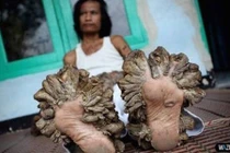 Những hình ảnh đáng sợ nhất về cơ thể đột biến 