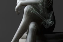 Tác hại giật mình của tư thế ngồi bắt chéo chân thanh lịch