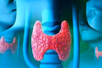 Chỉ dẫn giúp ngừa ung thư tuyến giáp hiệu quả