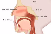 Dấu hiệu phát hiện ung thư cổ họng sớm