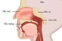 Dấu hiệu phát hiện ung thư cổ họng sớm