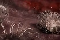 Kinh hoàng xem vi khuẩn “ăn thịt người” hoành hành