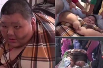 Chàng trai 300kg cắt dạ dày để giảm béo