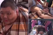 Chàng trai 300kg cắt dạ dày để giảm béo