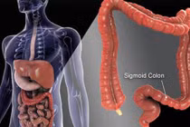 5 loại ung thư dễ cướp mạng đàn ông