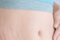 Làm mờ vết rạn da chỉ với 10 phút massage mỗi ngày