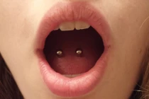 Tác hại khủng khiếp của việc xỏ khuyên lưỡi