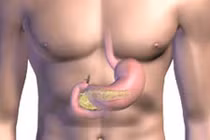 Nguyên nhân gây ung thư tuyến tụy