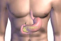 Nguyên nhân gây ung thư tuyến tụy