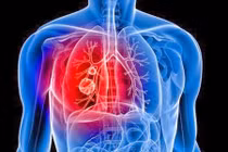 Truy tận gốc nguyên nhân cơn ho kéo dài không dứt