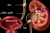 Tiết lộ lý do khiến bạn tiểu tiện nhiều lần trong ngày