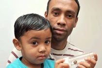 Hy hữu: Bé trai bị pin ăn mòn mũi vẫn sống khỏe