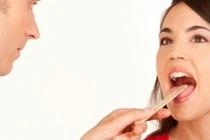 Cách dễ dàng ngăn ngừa ung thư lưỡi