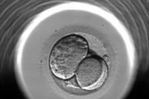 Phôi thai vừa hình thành, cha mẹ đã có thể quan sát