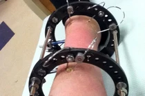 Gái trẻ nghiến răng chịu đau kéo dài chân làm đẹp