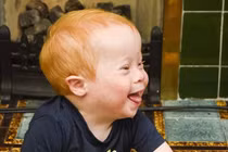 Chùm ảnh em bé bị Down vạn người mê trên mạng xã hội