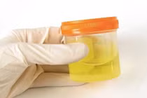 Những kiểu làm đẹp kỳ quặc từ nước tiểu