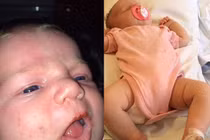 Mẹ hôn môi con, suýt làm con mất mạng