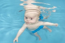 Bơi lội cứu sống bé sơ sinh bị tim bẩm sinh