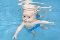 Bơi lội cứu sống bé sơ sinh bị tim bẩm sinh