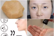 Những kiểu nâng mũi tạm thời gây choáng váng