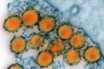 Thiếu nữ tự chữa khỏi HIV không cần thuốc