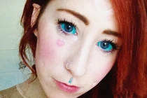 Rùng mình trào lưu xăm lòng trắng mắt làm đẹp 