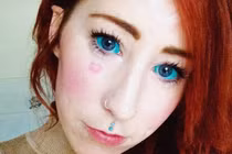 Rùng mình trào lưu xăm lòng trắng mắt làm đẹp 