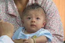Bé trai bị đâm xuyên sọ mắc viêm màng não mủ