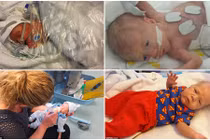 100 ngày kỳ diệu của em bé sinh non 4 tháng