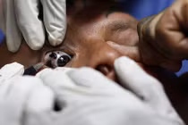 Hình ảnh kinh ngạc về thú chơi nhuộm mắt, xẻ lưỡi