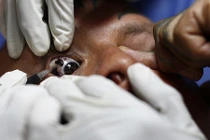 Hình ảnh kinh ngạc về thú chơi nhuộm mắt, xẻ lưỡi