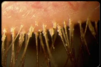 Hậu quả đáng sợ của những người đi ngủ không tẩy trang