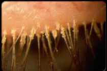 Hậu quả đáng sợ của những người đi ngủ không tẩy trang