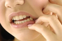 6 mẹo giảm đau răng cho bé không cần dùng thuốc