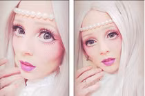 Căn bệnh hiểm biến thiếu nữ thành búp bê sống xinh đẹp