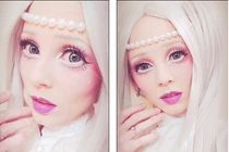 Căn bệnh hiểm biến thiếu nữ thành búp bê sống xinh đẹp