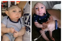 Giải mã hiện tượng em bé không có hộp sọ vẫn sống