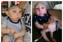 Giải mã hiện tượng em bé không có hộp sọ vẫn sống