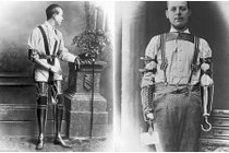 Xem ảnh thật những bộ chân tay giả từ thế kỷ 19